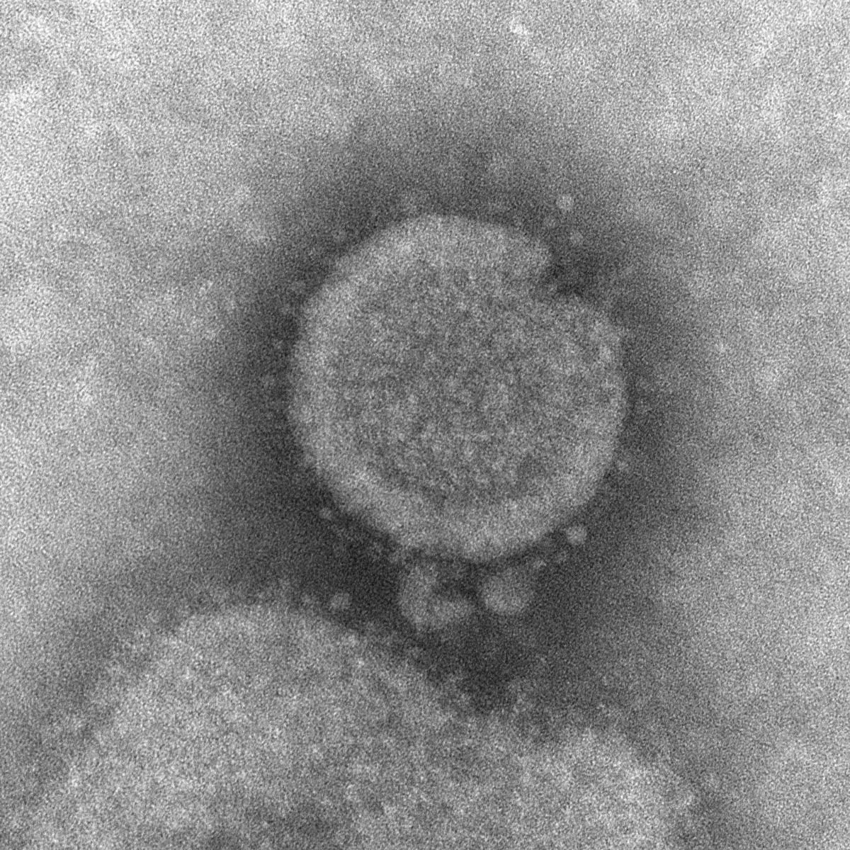 Influenza A H7N9