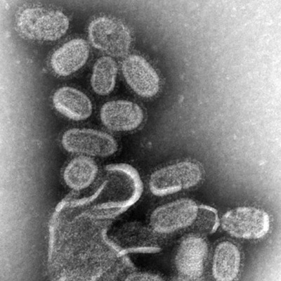 TEM of the reconstructed 1918 pandemic influenza virus